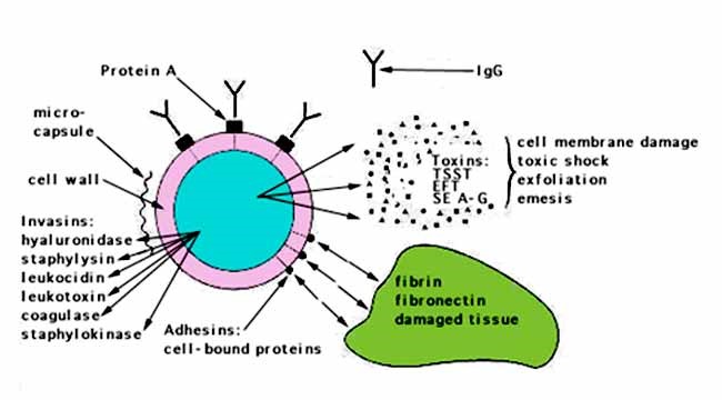 Epidemiology of Staphylococcus aureus 