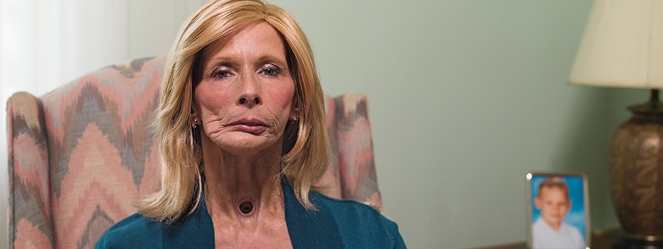 Image of Terrie on how smoking affected her