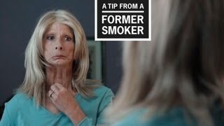 Image of Terrie H. ad on smoking