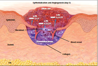 Epithelization and angiogenesis