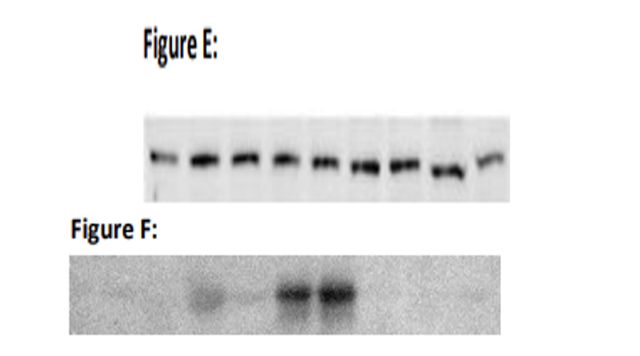 Western Blot Analysis of XIAP Expression in NTC and XIAP-KO HepG2 Cells Under Various Treatments