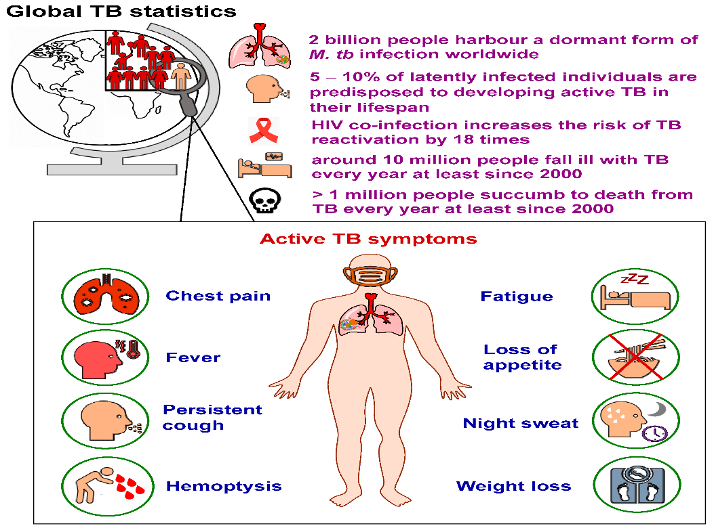 Signs and Symptoms of Tuberculosis