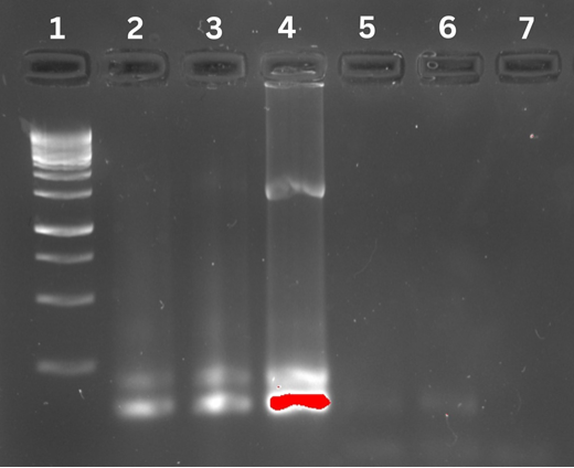 shows the results of gel electrophoresis and Kanamycin Cassette analysis conducted on the Plasmid type per Murphy's paper dated 2016
