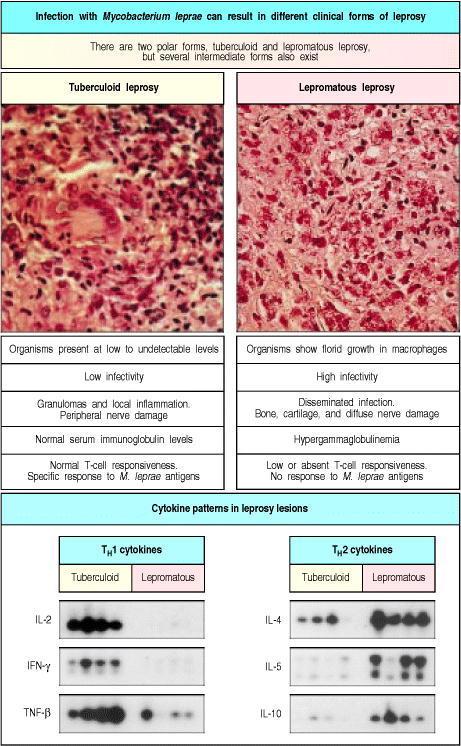 Biofilm mechanisms of immune evasion