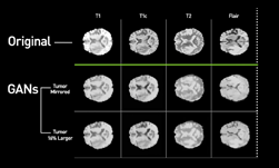 Comparison of original brain MRI scans and GANs-generated synthetic scans