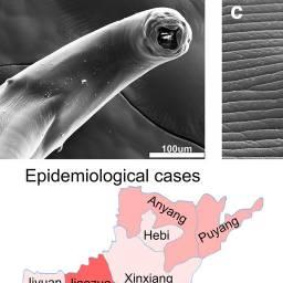 Images of the Disease